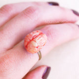 brain ring